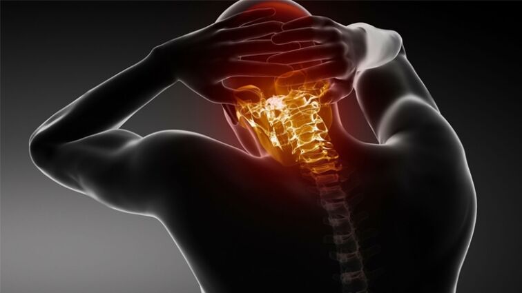 Dolor en la nuca con osteocondrosis cervical.