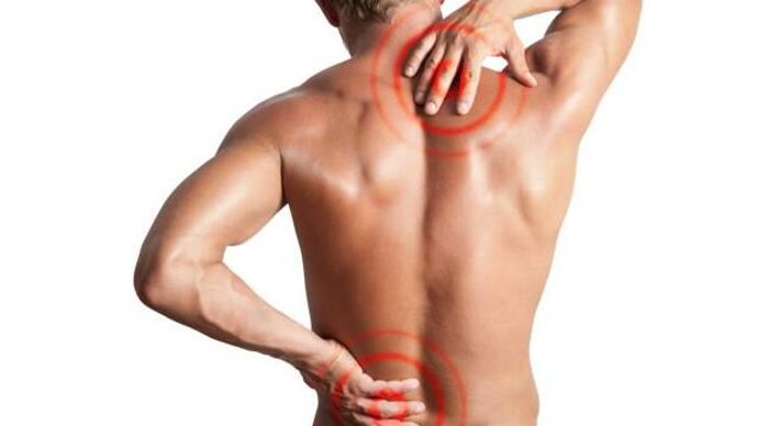 Dolor debido a la osteocondrosis.